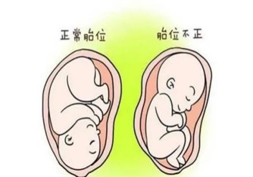 石斛的作用与功效有哪些,什么样的人不适合吃石斛